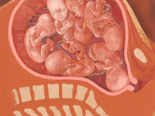 sextuplets