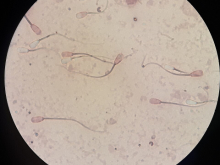 Sperm